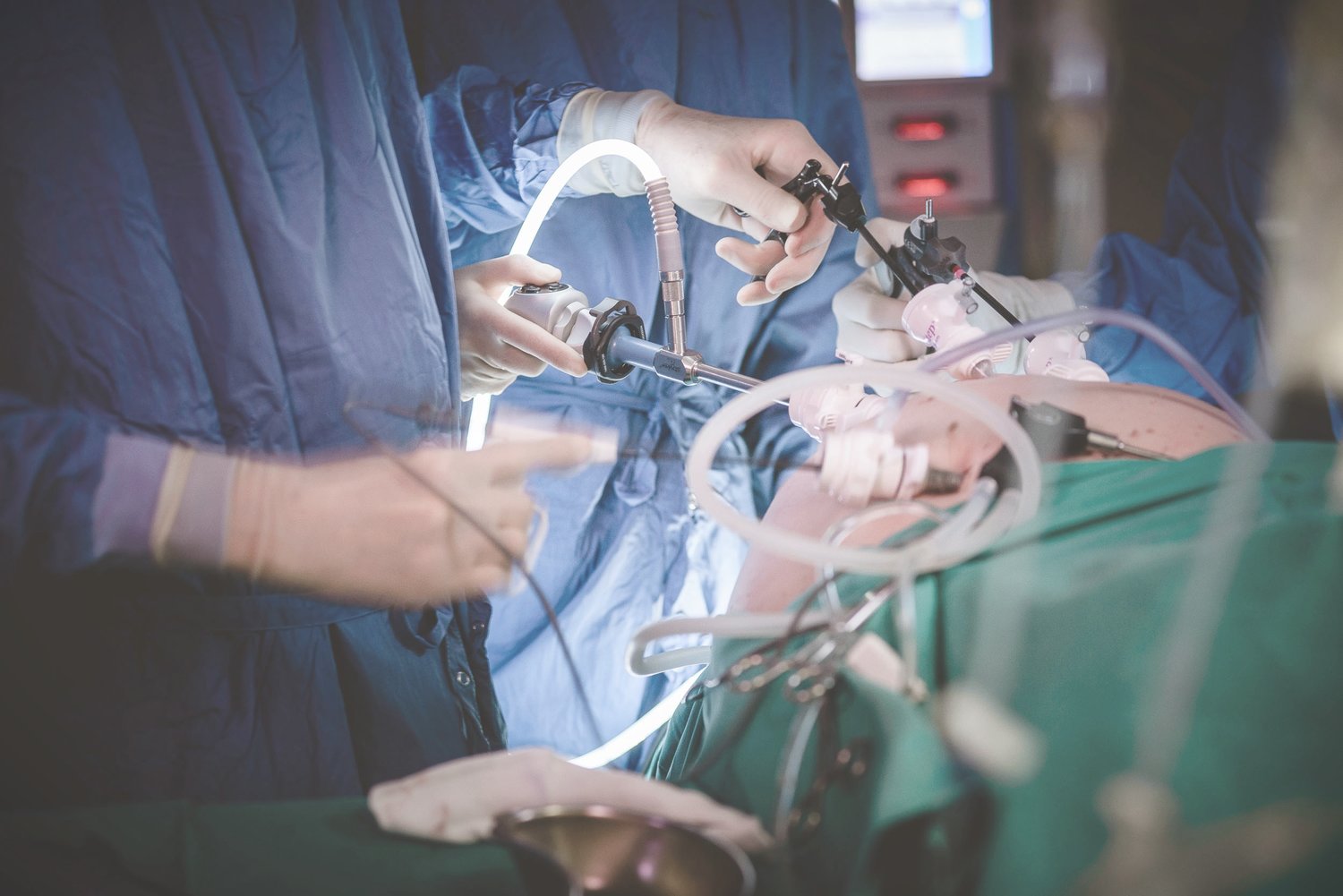 Anti Reflux Surgery Gwinnett Surgical Specialists